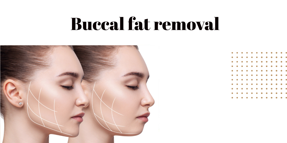 Buccal-fat-removal